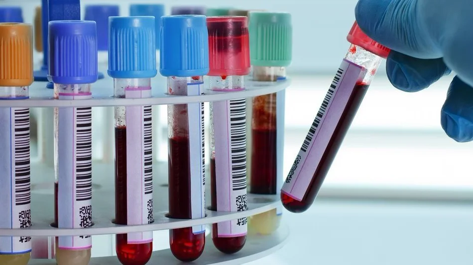 Un examen de sangre experimental permite detectar de forma precoz 8 tipos de cáncer