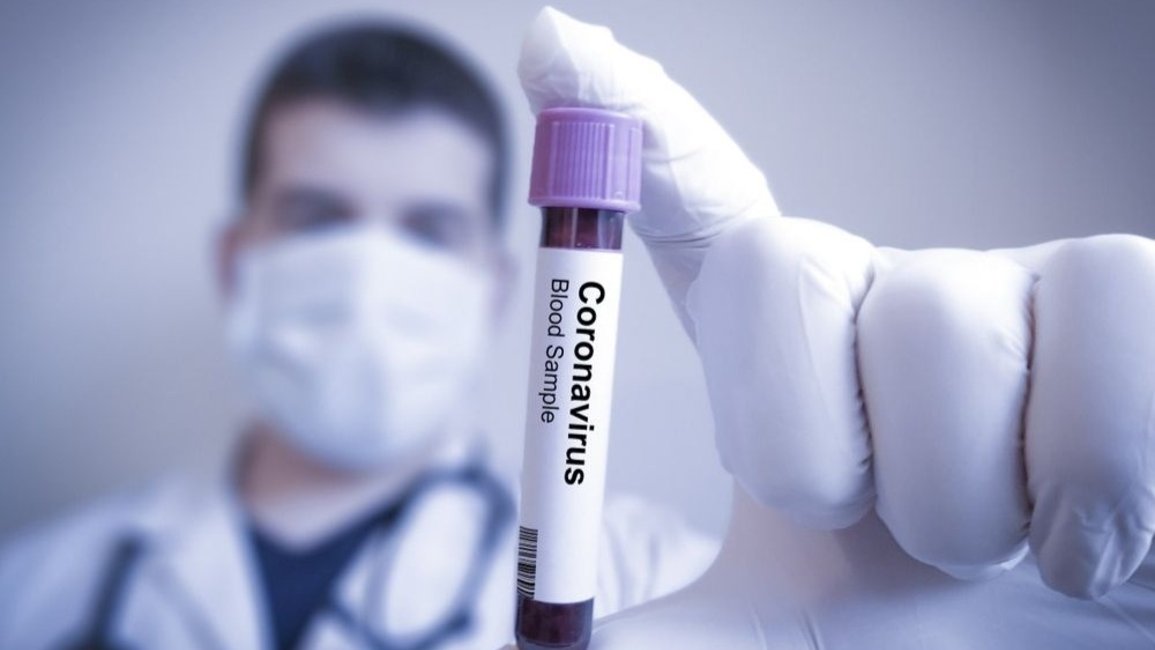 Hoy se confirmaron 54 nuevos casos de coronavirus en Salta