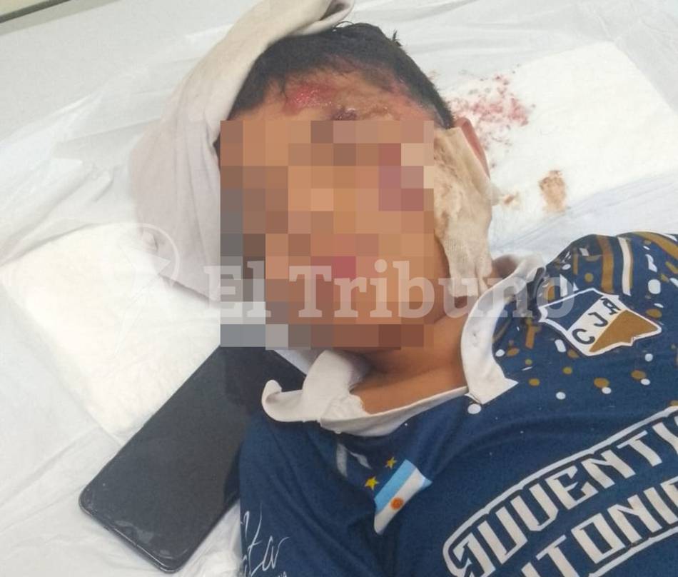 VIDEO. Atropellaron a un nene, el auto huyó y los vecinos de barrio Libertad exigen respuestas 