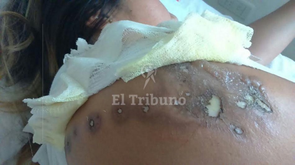 Una mujer recibió una descarga eléctrica en la calle y está internada