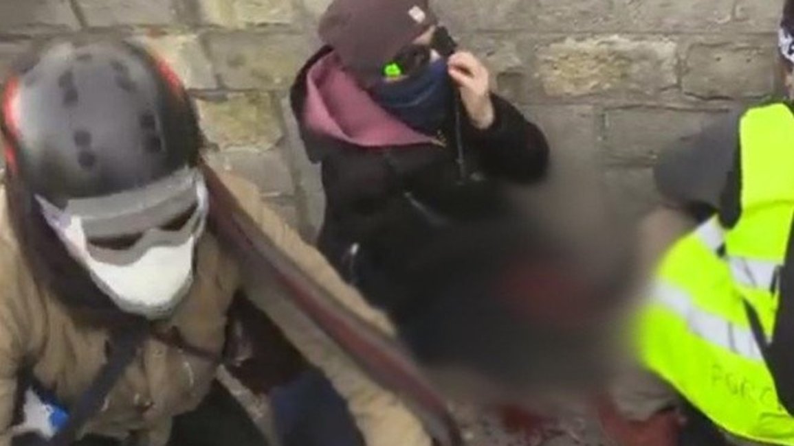 Un manifestante perdió una mano durante una protesta de los chalecos amarillos