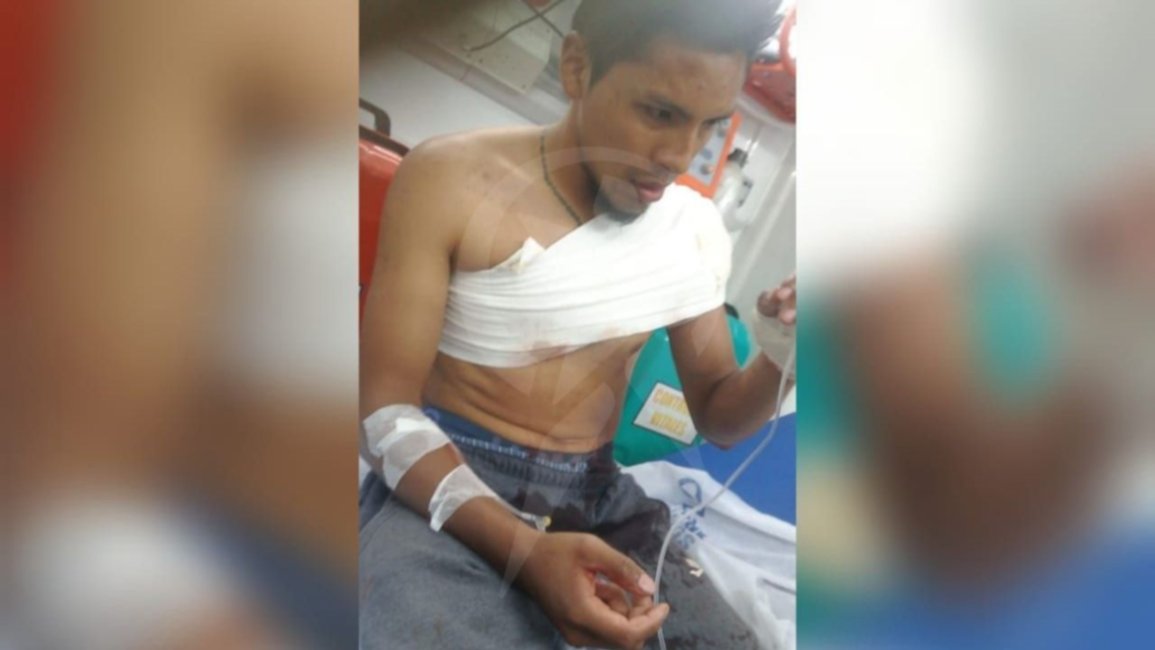 Campo Qujano: acuchilló a un verdulero por desquite y se fue a trabajar tranquilamente