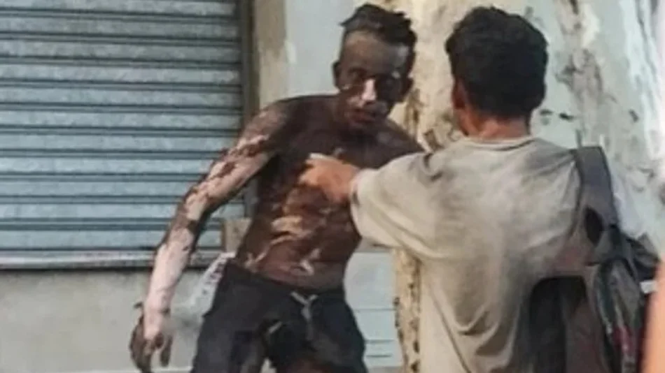 VIDEO. Intentó robar cables de alta tensión en Rosario y se electrocutó: tiene el 90 por ciento del cuerpo quemado