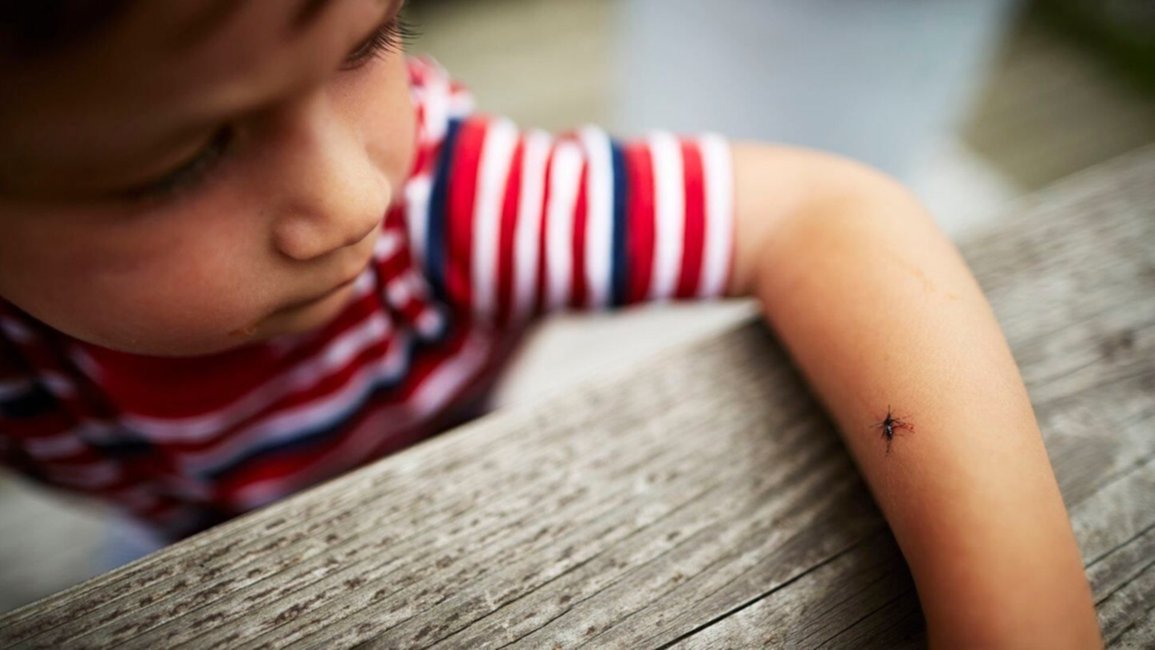 Dengue: “Hay que estar atentos a los síntomas que se pueden presentar en los niños”