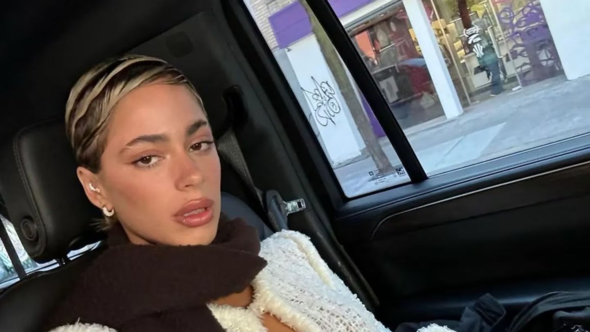 Tini Stoessel subió una alarmante foto a sus redes y preocupó a sus fanáticos