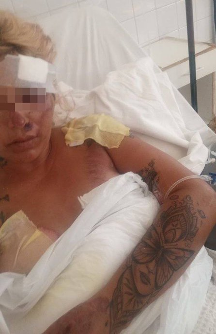 Tragedia en la avda. Paraguay: una de las víctimas mostró cómo quedó después de ser atropellada y pide ayuda