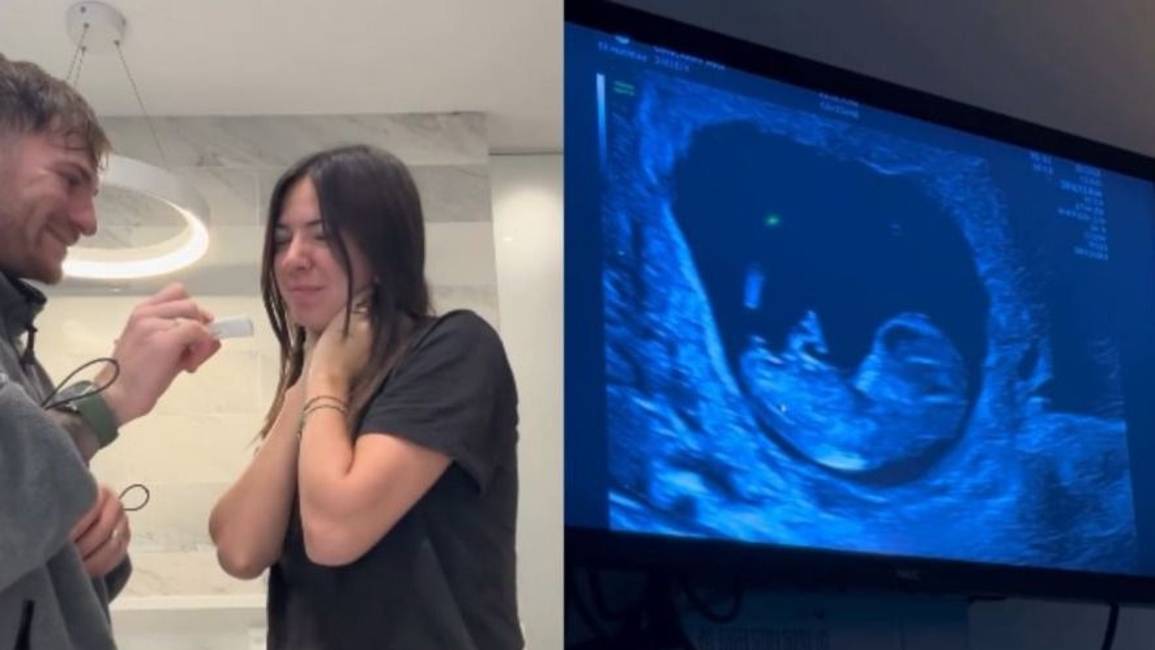 Alexis Mac Allister y Ailén Cova confirmaron que serán padres de una niña