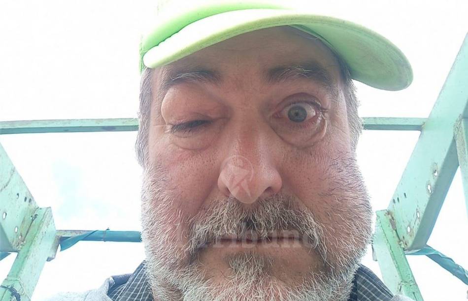 Metán: "Me estaban patoteando y yo me defendí", dijo el hombre que cabeceó a un joven