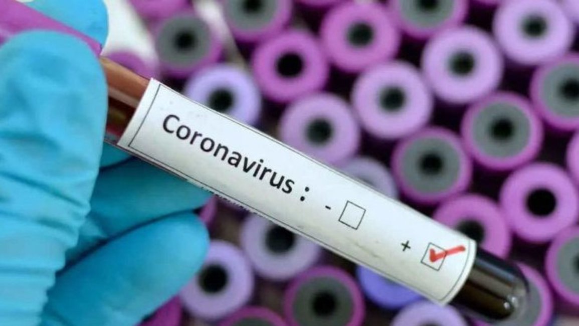Confirmaron 103 nuevos casos de coronavirus en el país y el total asciende a 1.554 con 48 muertos
