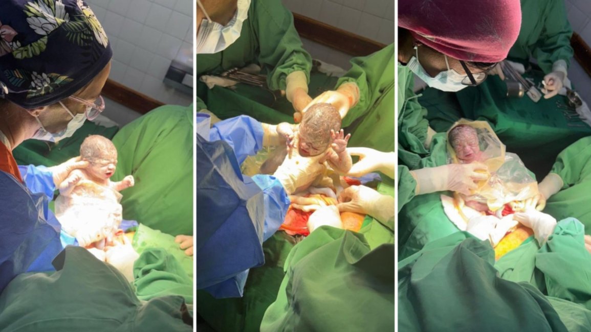 Nacieron trigemelos en Salta: un caso poco frecuente que ocurre en 1 de cada 6.400 embarazos
