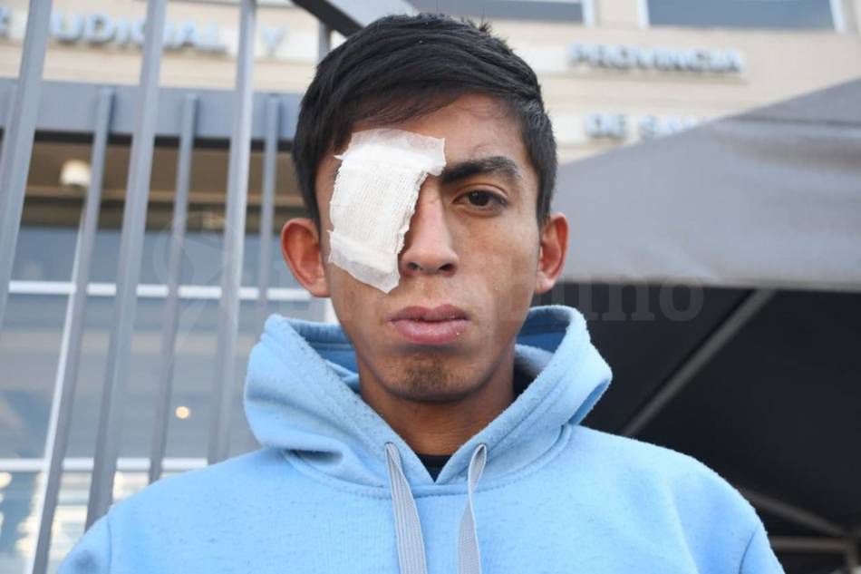 Barrio Solidaridad: un joven podría perder el ojo tras un disparo y su padre exige que la policía se haga responsable