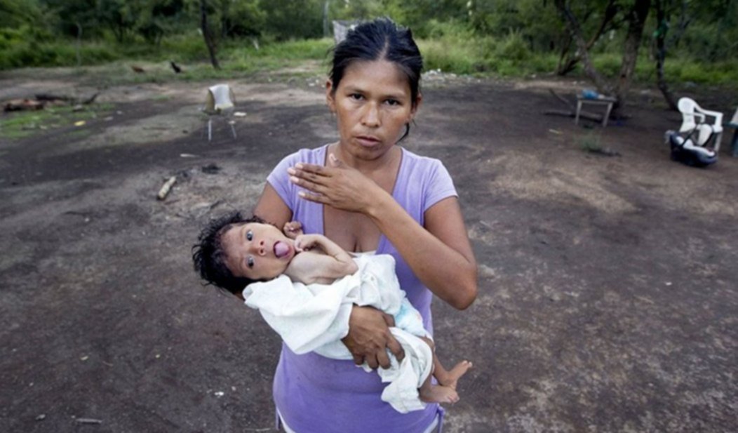 Reconocen que hay 160 desnutridos en el Chaco Desnutrici n infantil