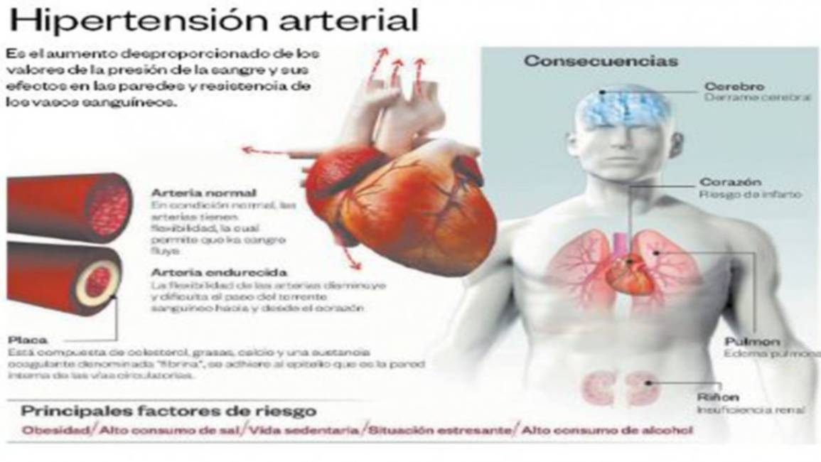 Dolor de cabeza y mareo: ¿estrés o hipertensión? | Presión arterial