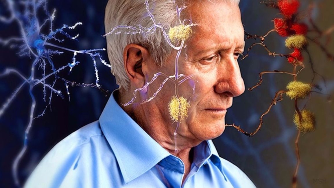 Un estudio revela cuál podría ser el primer signo del Alzheimer