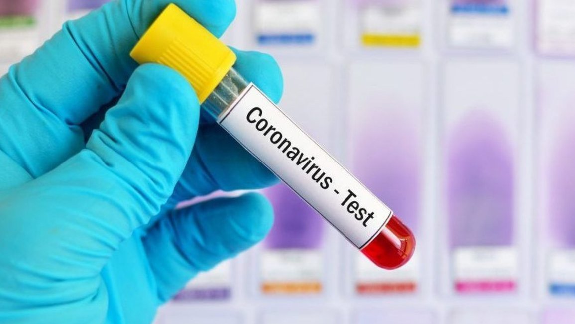 Se confirmaron 559 casos de coronavirus en Salta y 9 muertes en las últimas 24 horas