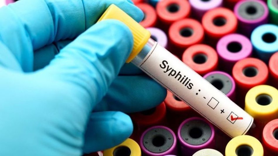 Preocupa el aumento de los casos de sífilis: se triplicaron desde 2013