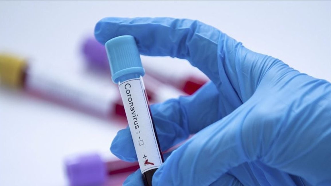 Se notificaron 361 nuevos casos de coronavirus en Salta