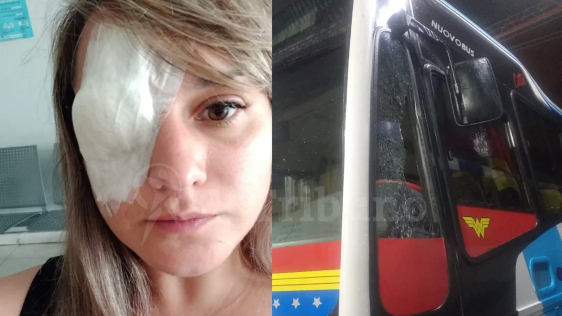 Romina, la chofer valiente que quedó con secuelas tras un ataque cobarde