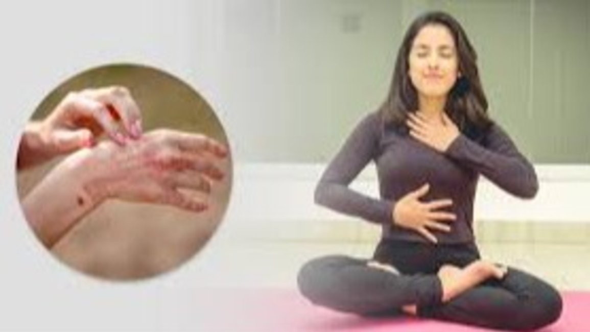 Mindfulness y psoriasis: una propuesta gratuita para mejorar tu piel y tu bienestar 