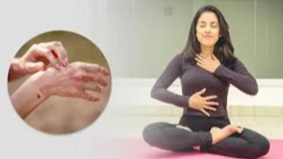 Mindfulness y psoriasis: una propuesta gratuita para mejorar tu piel y tu bienestar 
