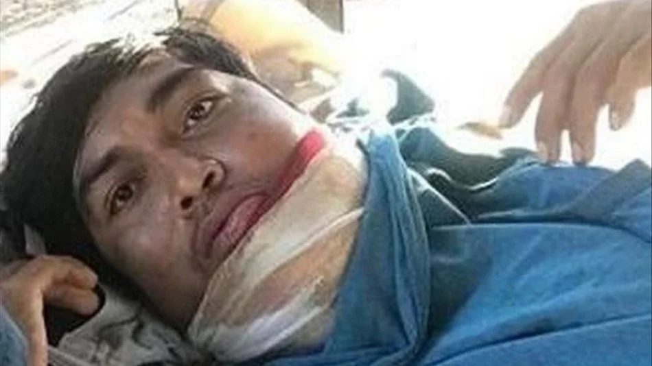 Murió el joven con cáncer de mandíbula