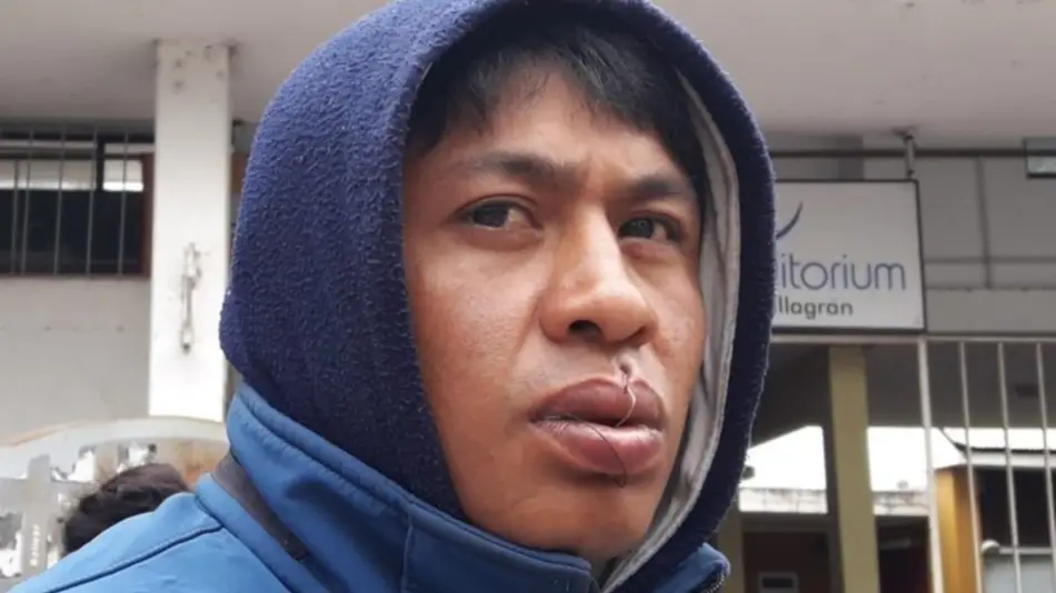 Un hombre se cosió la boca y se encandenó en el IPV