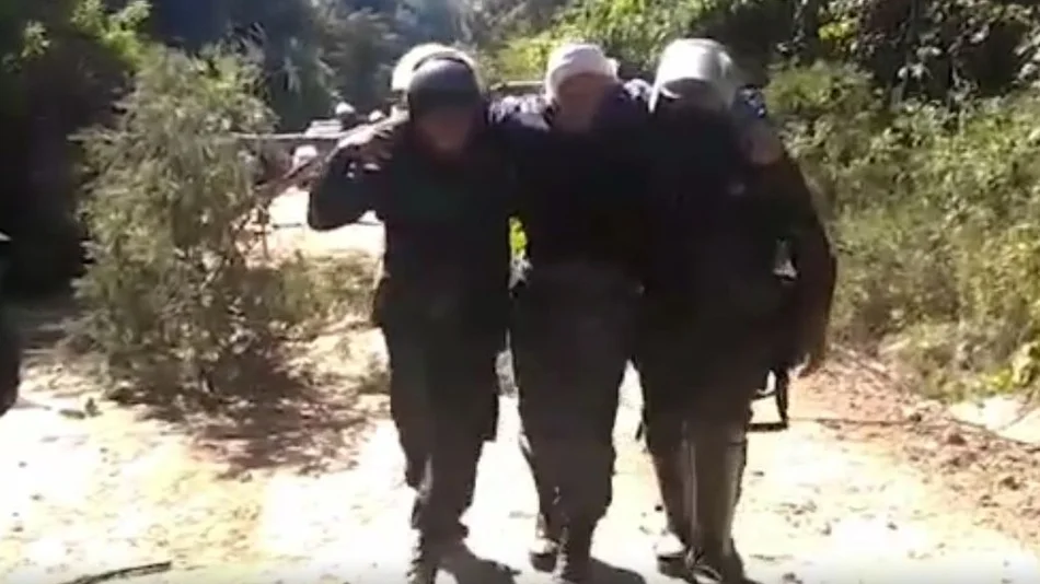 Tras el incidente en Acambuco, operaron a un policía herido