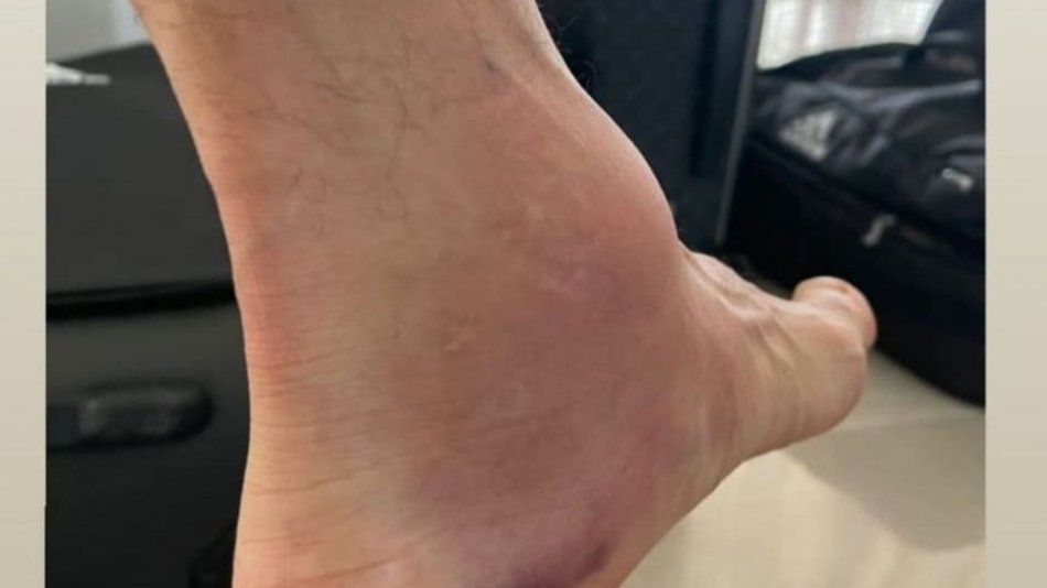 Impactante imagen de como quedó en el tobillo Di María