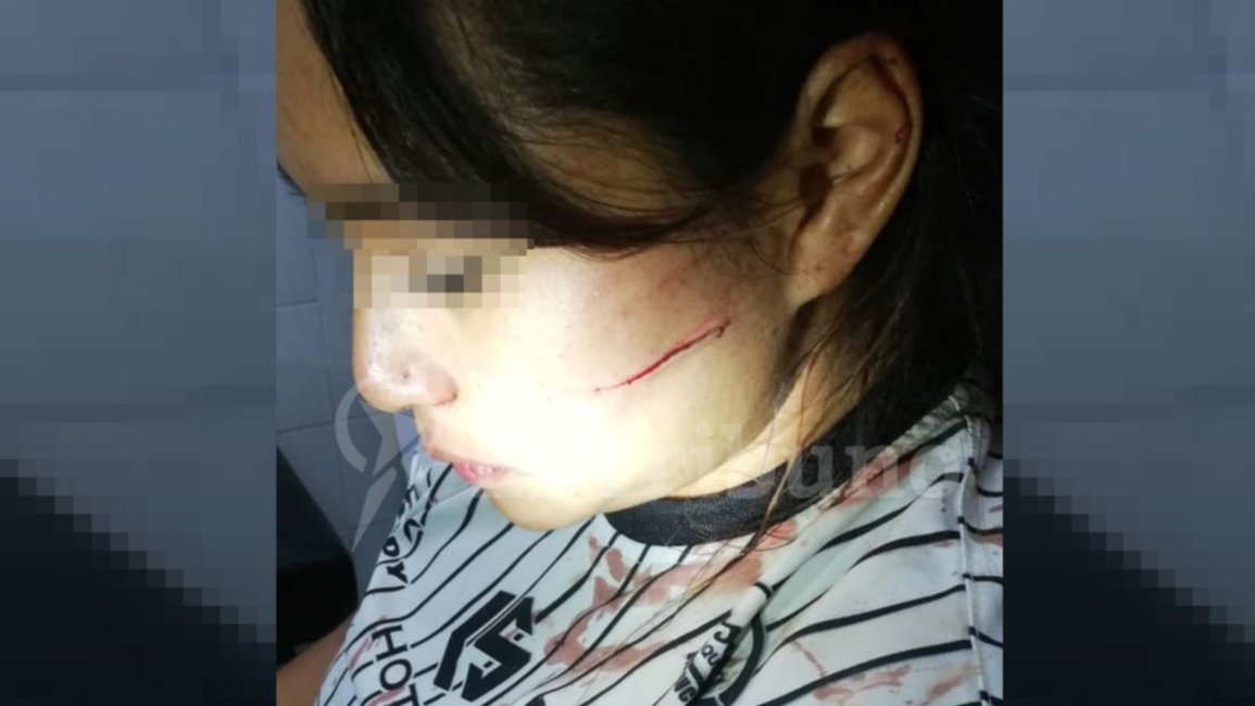 Joven madre teme por su vida, la Justicia quiere liberar a su agresor