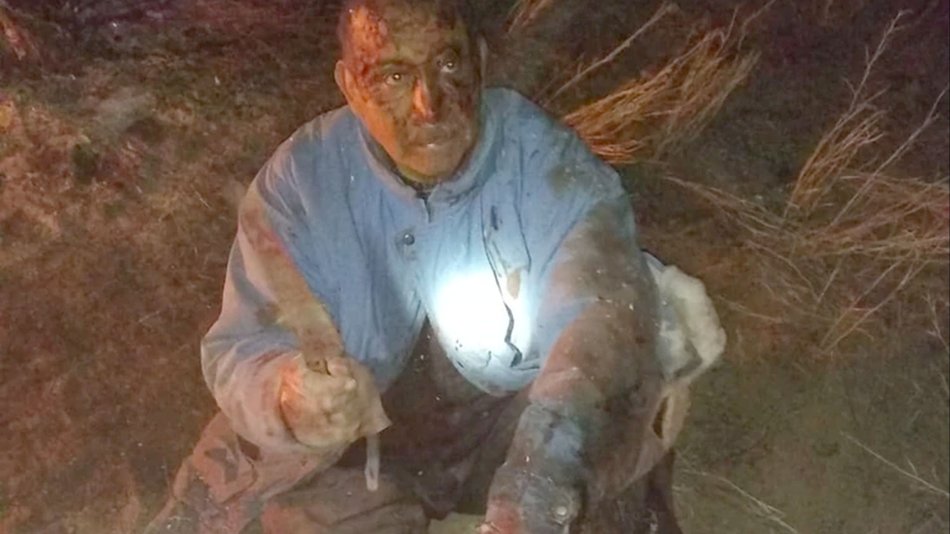 Peleó mano a mano con un puma para salvar a su perro: fue rescatado tras 12 horas 