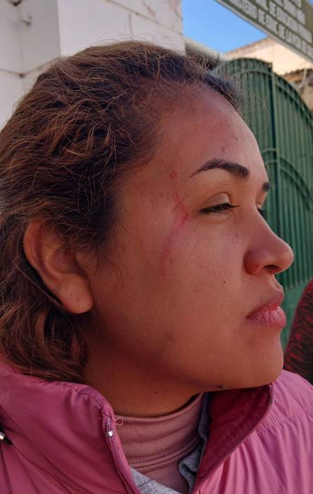 Güemes: Despiden a tres empleadas por agredir a una edil en el Concejo
