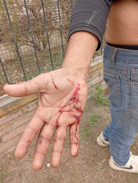 Crece la tensión en Hipólito Yrigoyen tras una brutal represión: un trabajador perdió un ojo