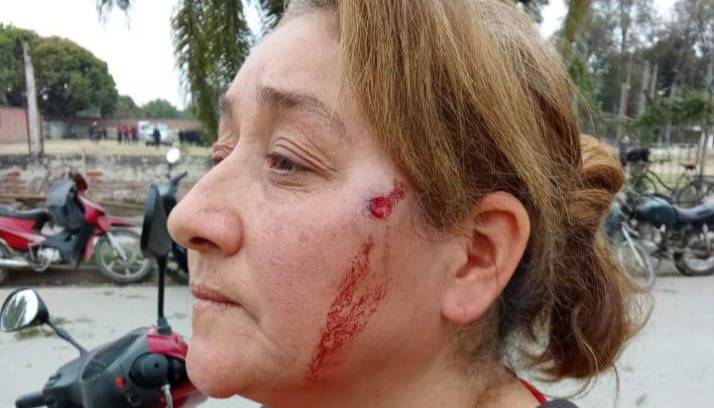 Crece la tensión en Hipólito Yrigoyen tras una brutal represión: un trabajador perdió un ojo