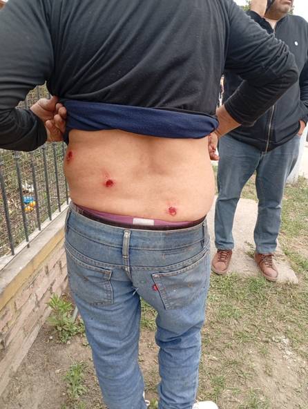Crece la tensión en Hipólito Yrigoyen tras una brutal represión: un trabajador perdió un ojo
