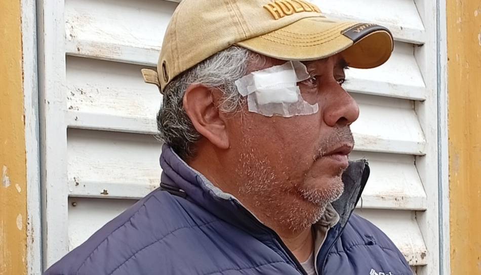 Crece la tensión en Hipólito Yrigoyen tras una brutal represión: un trabajador perdió un ojo