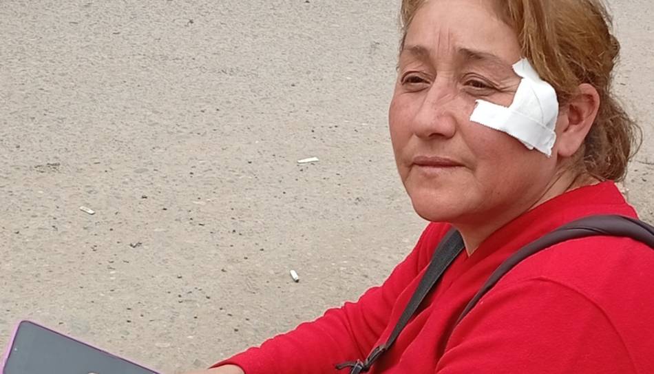 Crece la tensión en Hipólito Yrigoyen tras una brutal represión: un trabajador perdió un ojo