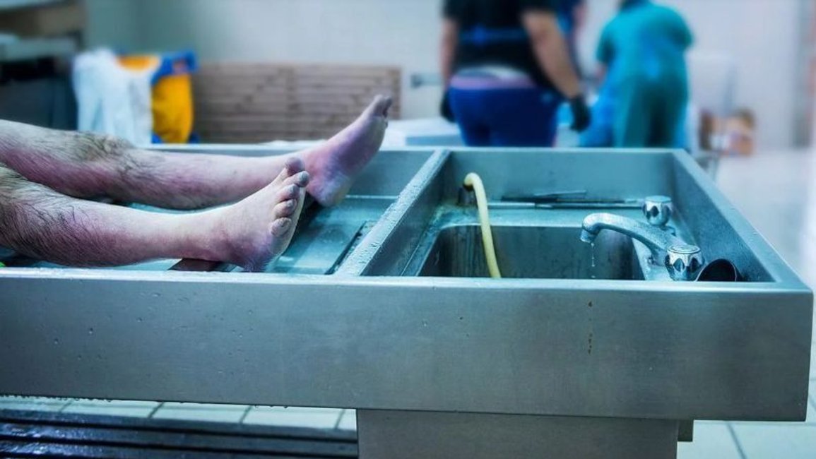 Estaba “muerto”, despertó en la morgue y volvió a la fiesta donde sufrió un coma 