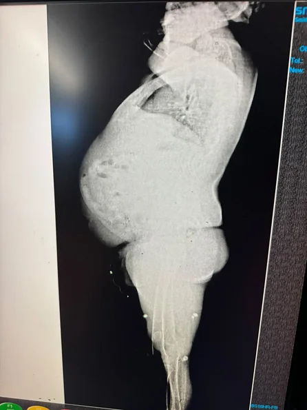 Salió de Salta con casi 200 cápsulas de cocaína en su cuerpo: detuvieron a una mujer y a su reclutador- Salió de Salta con casi 200 cápsulas de cocaína en su cuerpo: detuvieron a una mujer y a su reclutador