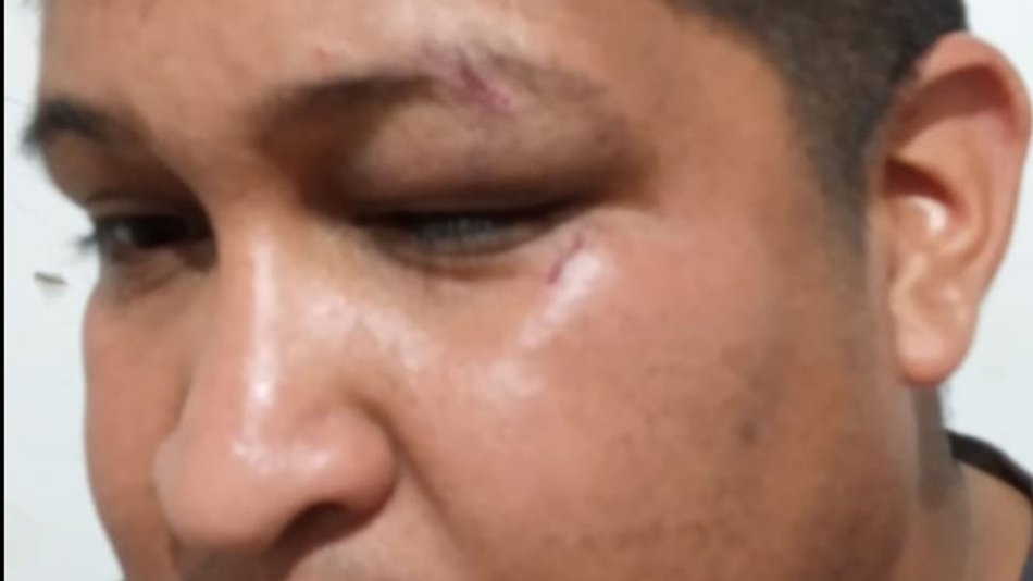  Agreden a un taxista en la zona de la Terminal: “Hay toda una mafia en la parada 23”