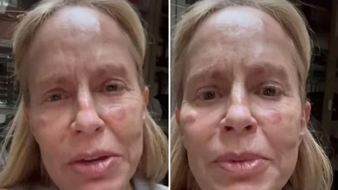 El mal momento de salud de Cecilia Bolocco: "Estaba muy asustada"