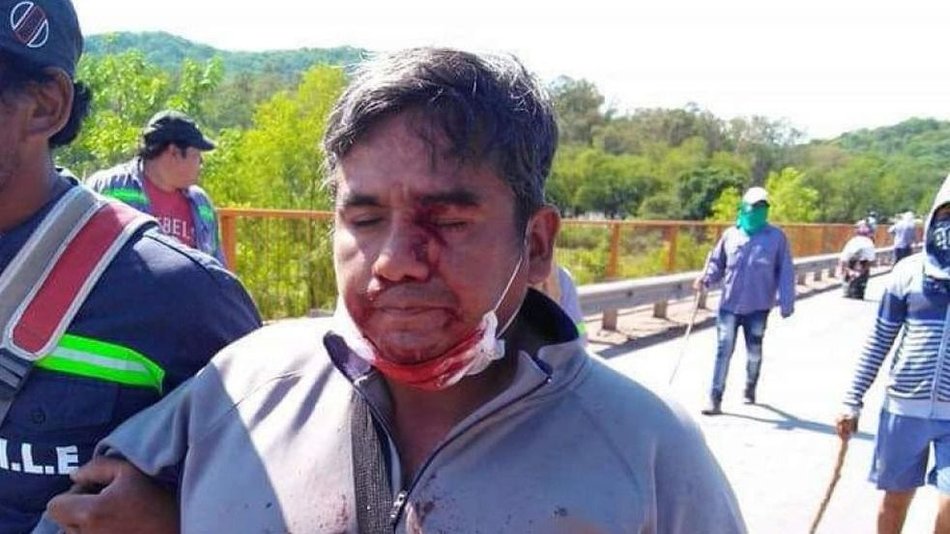 Una docena de heridos, 50 detenidos y pedido de captura para los dirigentes azucareros de La Esperanza
