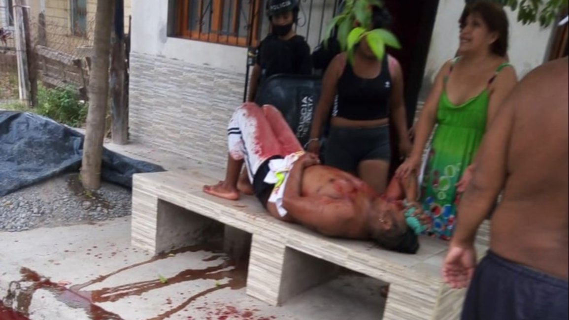 Tras una discusión en la vía pública, un hombre fue apuñalado 