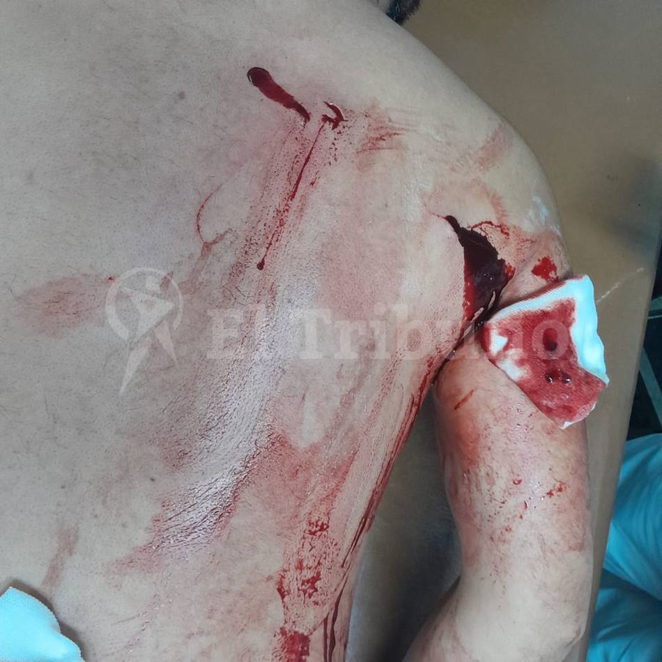 Piden la detención de una mujer por reiterados hechos de violencia contra su ex pareja en Tartagal